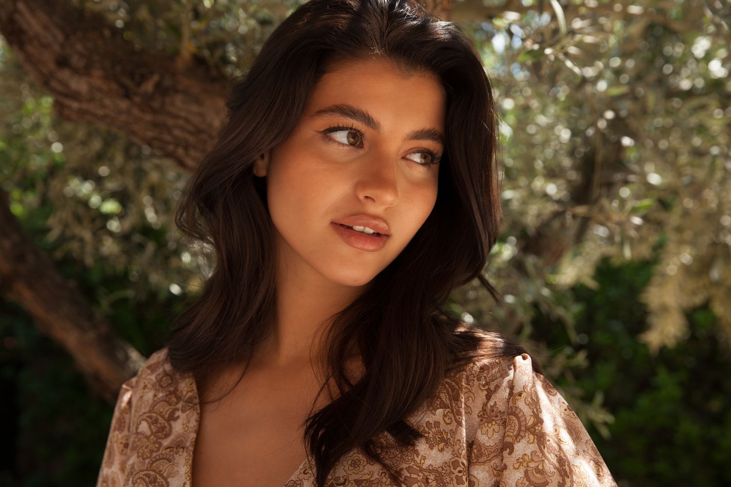 Woodland Hills dermal fillers model with dark hair