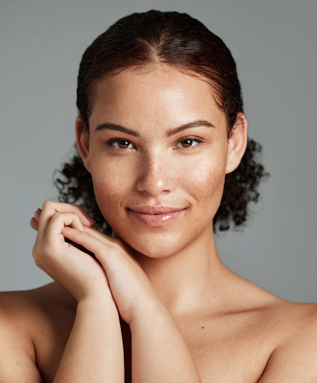 woodland hills skin rejuvenation model smiling